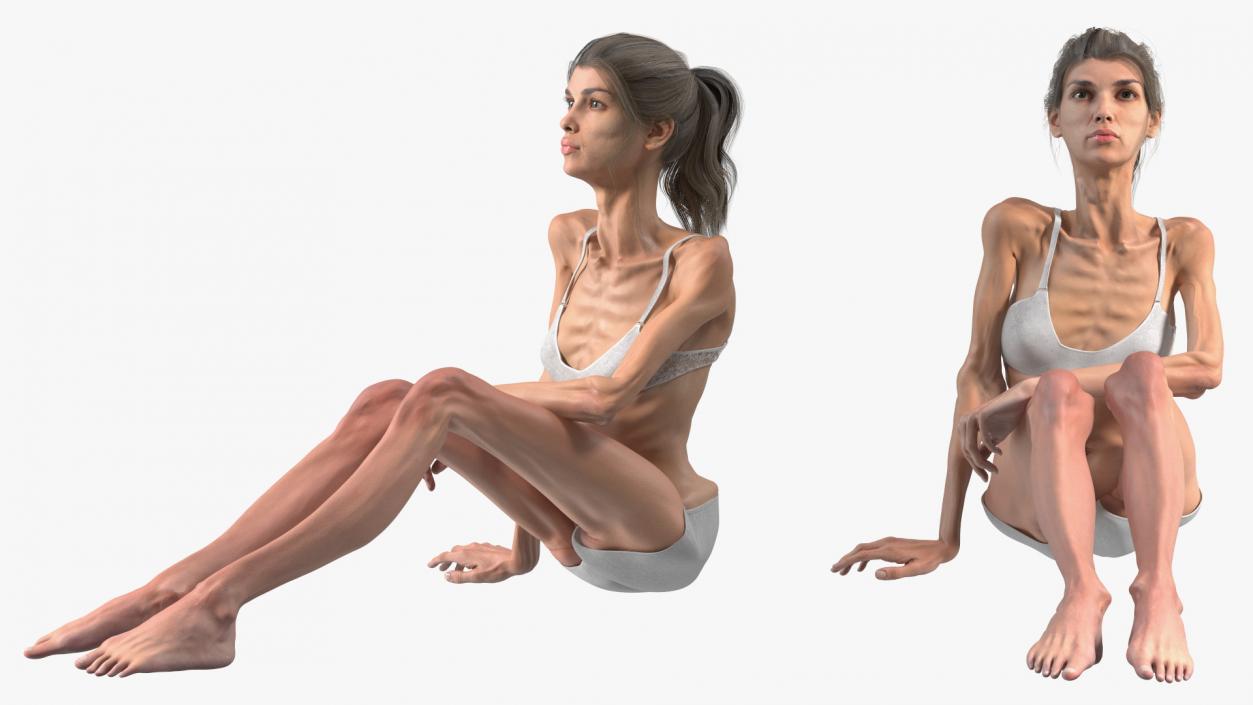 Sitting Anorexic Woman 3D