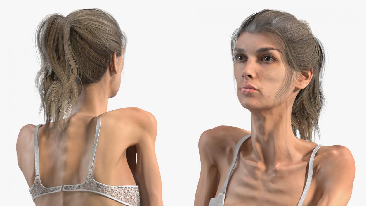 Sitting Anorexic Woman 3D