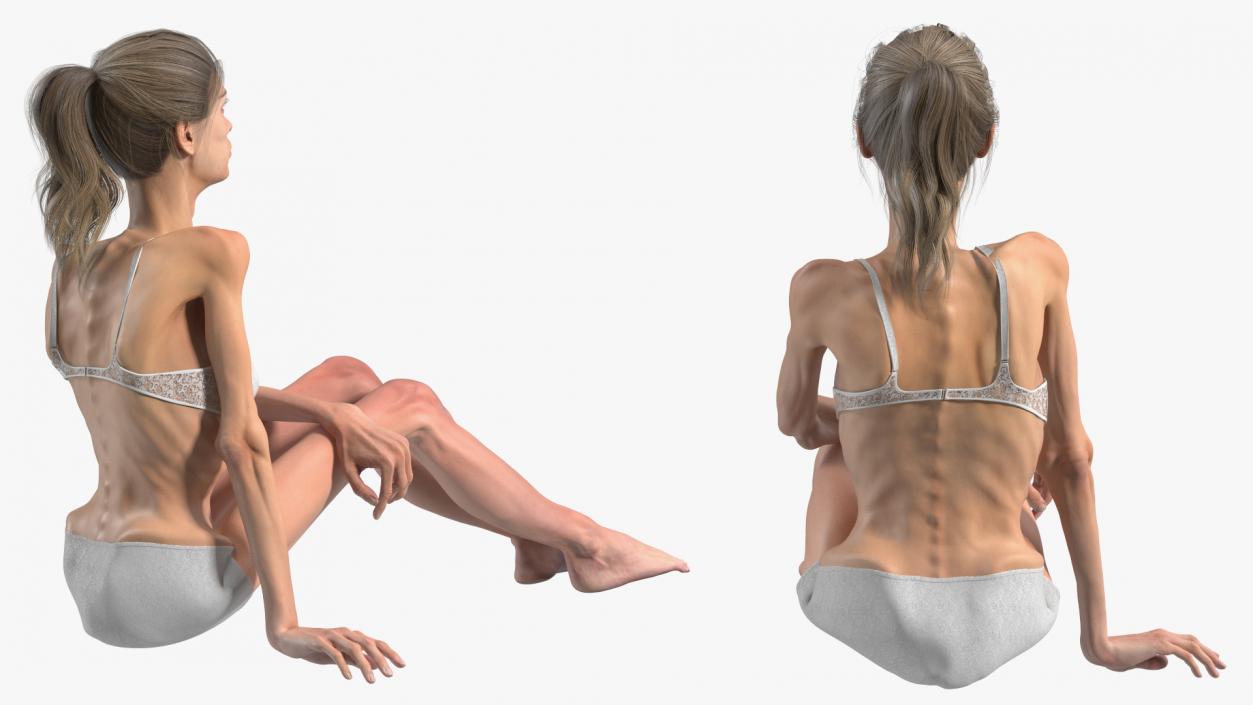 Sitting Anorexic Woman 3D