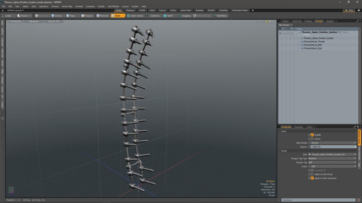 Thoracic Spine Fixation System 2 3D