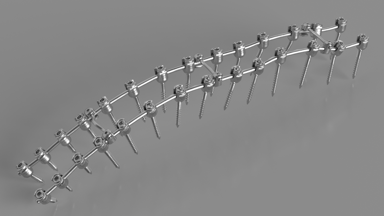 Thoracic Spine Fixation System 2 3D