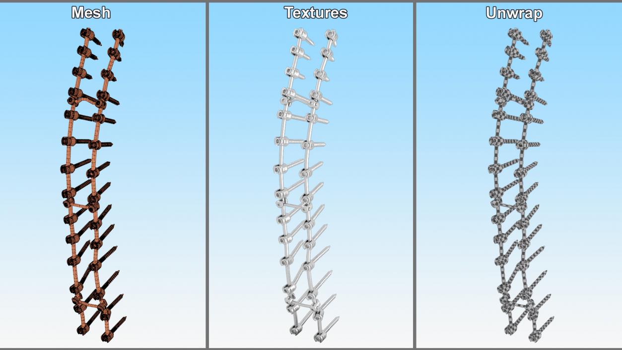 Thoracic Spine Fixation System 2 3D