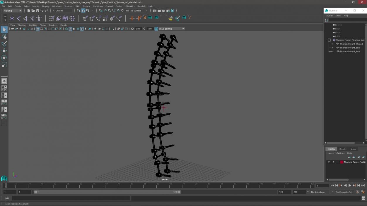 Thoracic Spine Fixation System 2 3D