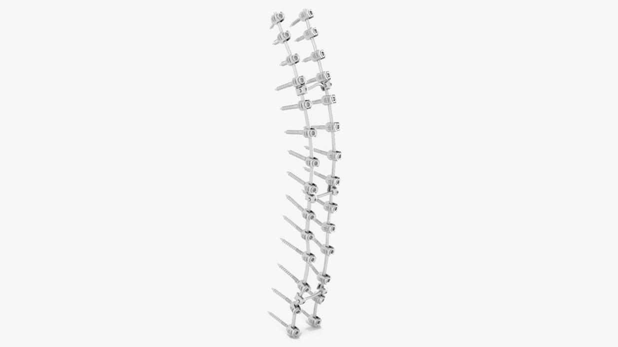 Thoracic Spine Fixation System 2 3D