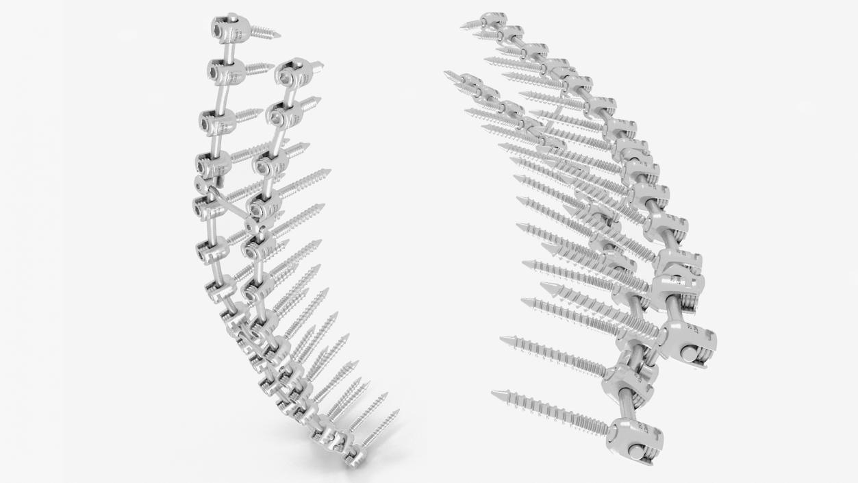 Thoracic Spine Fixation System 2 3D