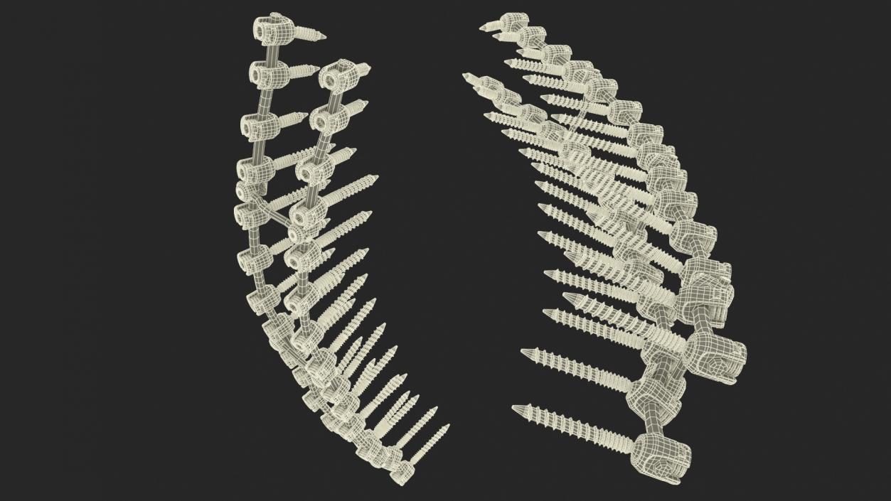 Thoracic Spine Fixation System 2 3D