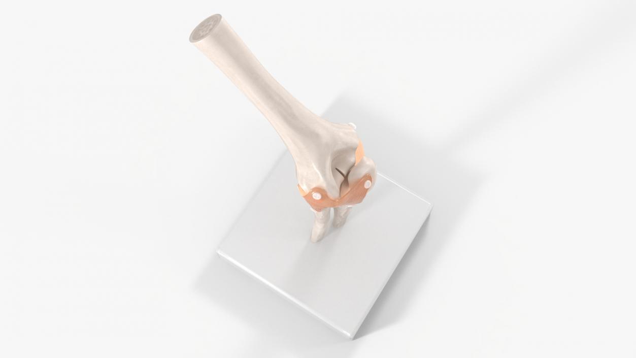 3D Elbow Joint