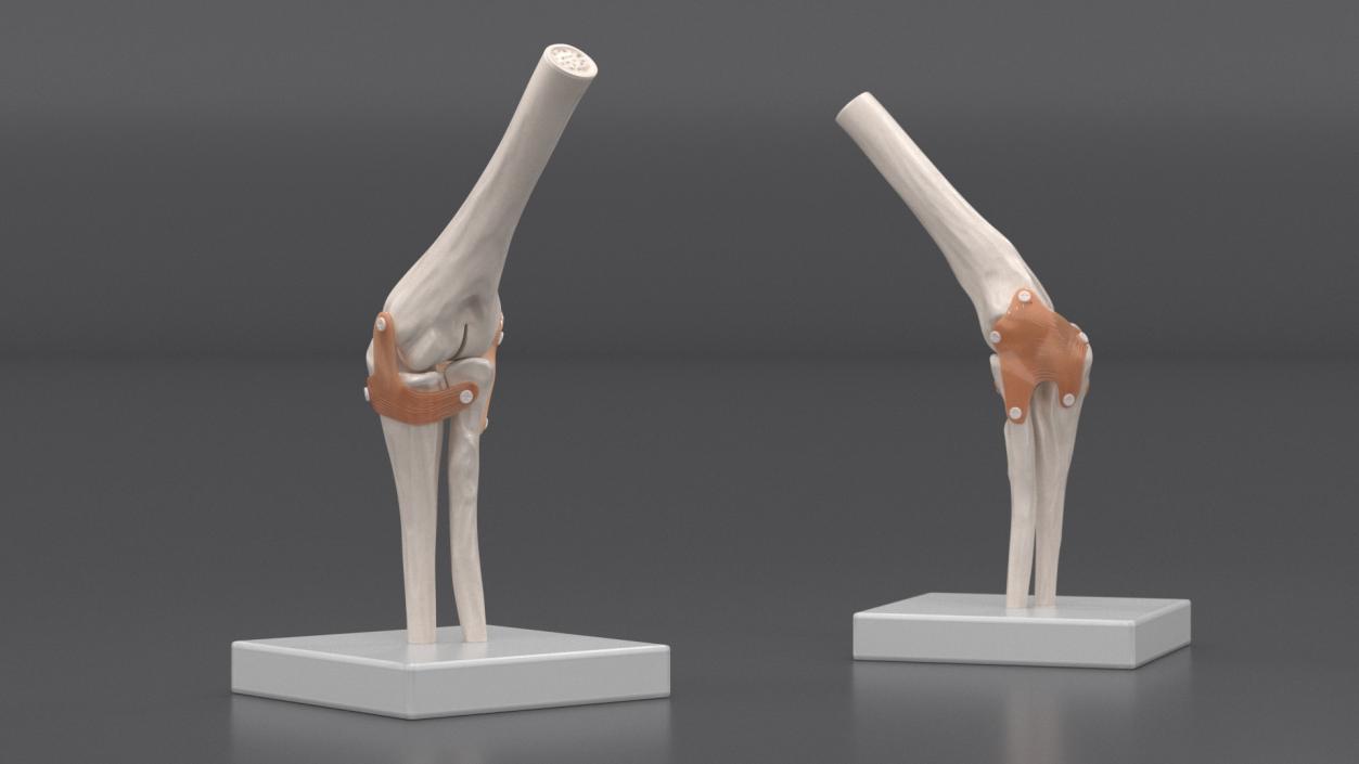 3D Elbow Joint