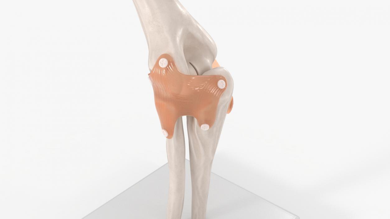 3D Elbow Joint