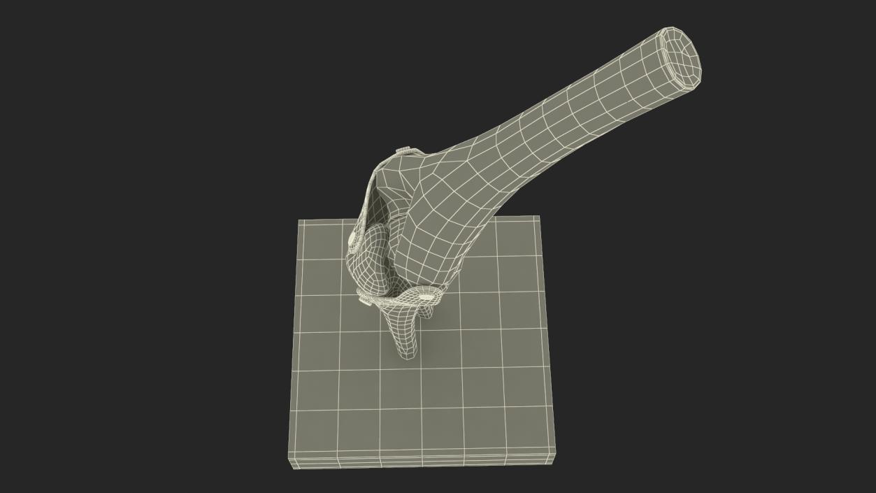 3D Elbow Joint