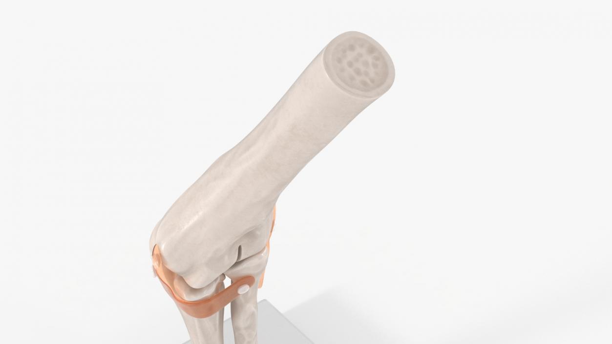 3D Elbow Joint