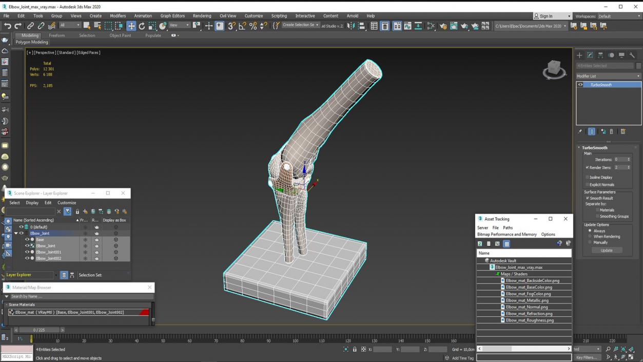 3D Elbow Joint