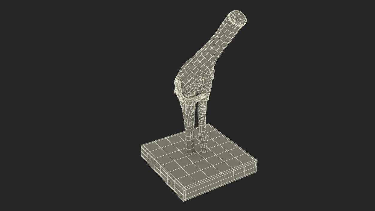 3D Elbow Joint