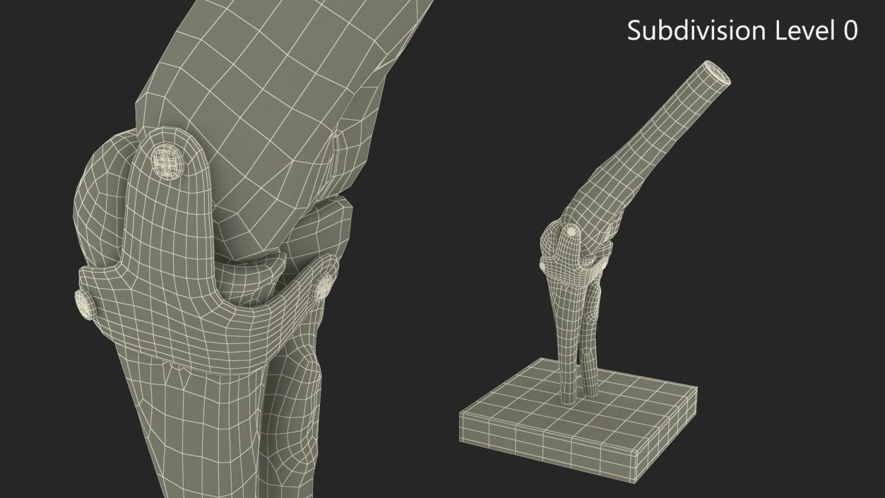 3D Elbow Joint