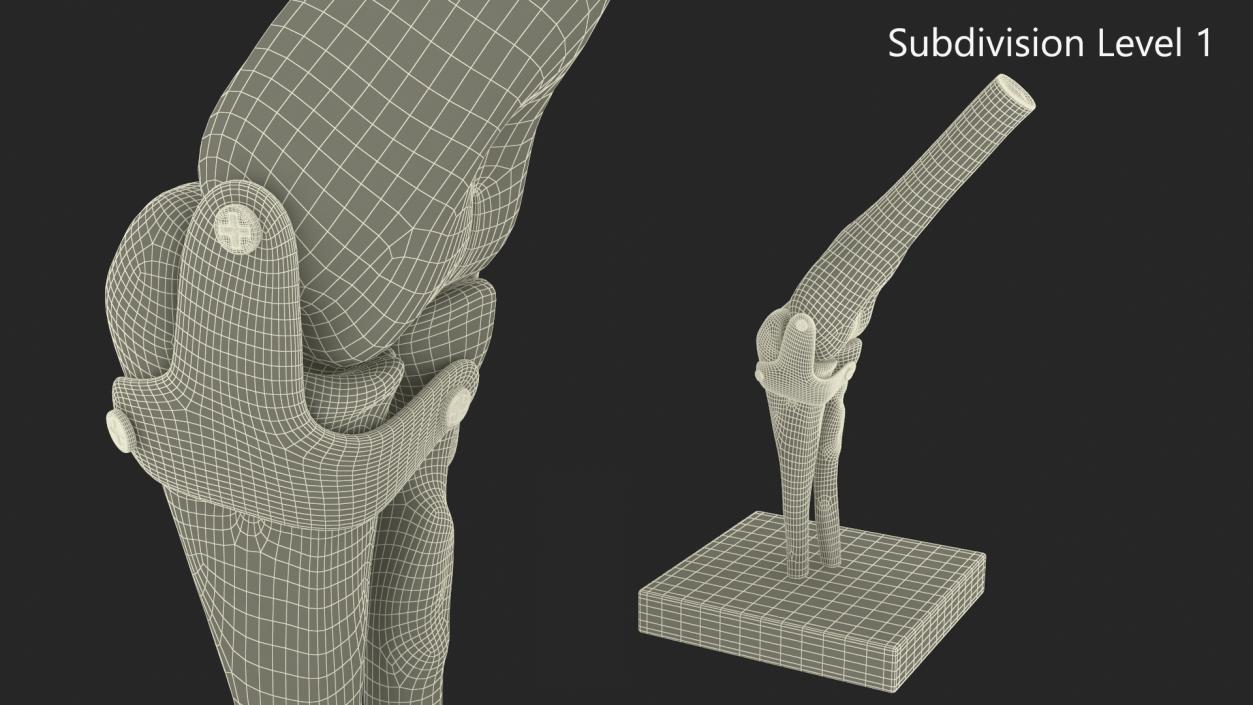 3D Elbow Joint