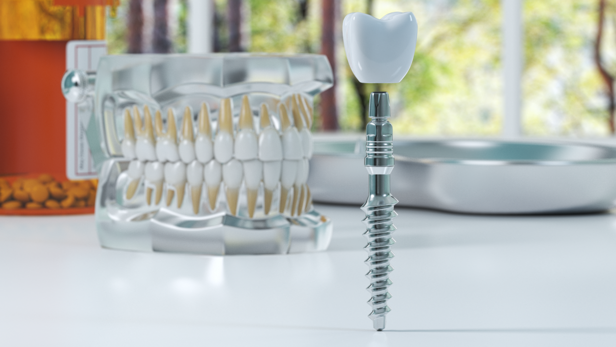 3D KOS Series Dental Implants 6 cm