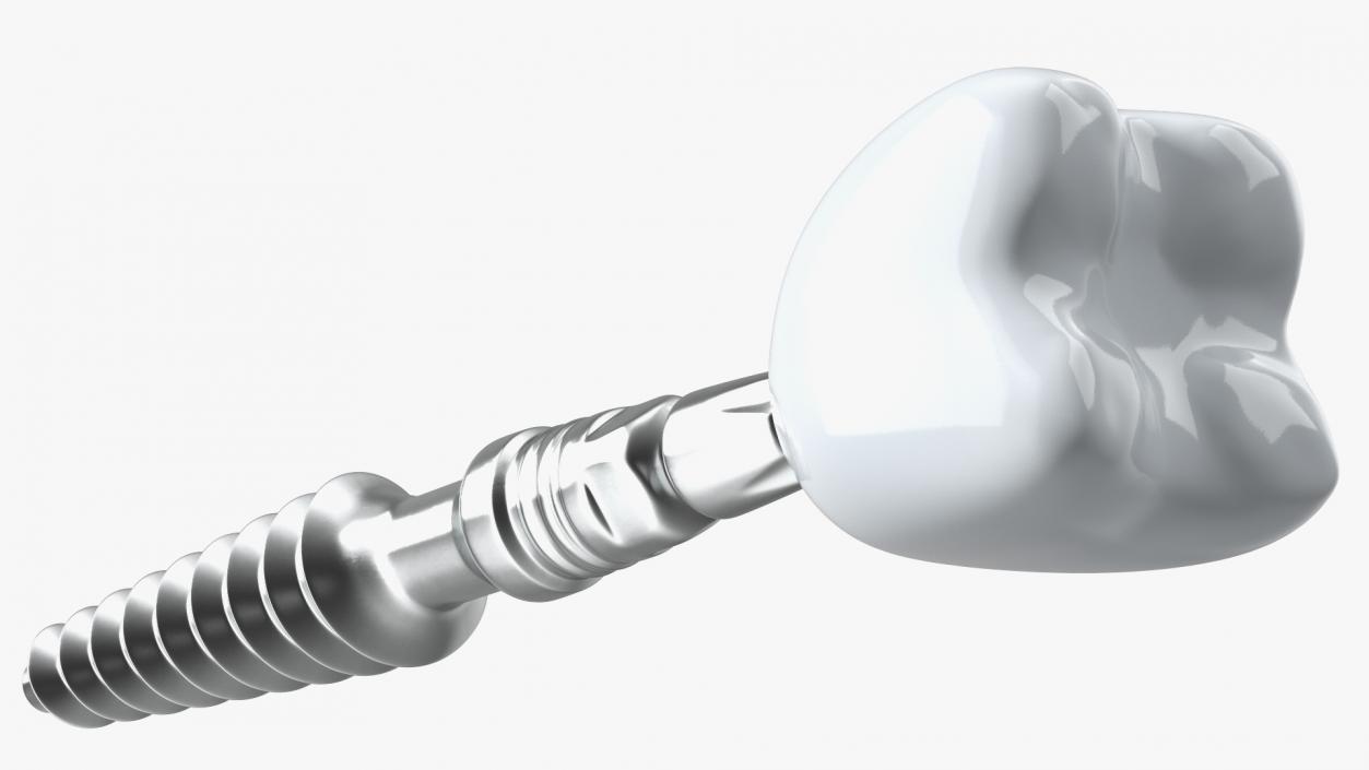 3D KOS Series Dental Implants 6 cm