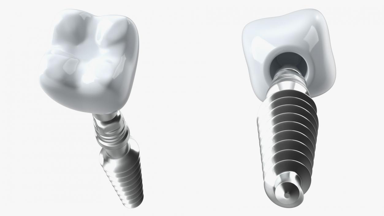 3D KOS Series Dental Implants 6 cm