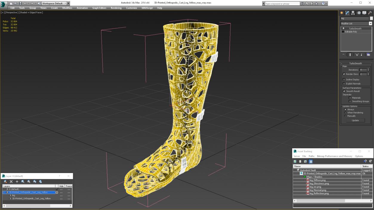 3D model -Printed Orthopedic Cast Leg Yellow