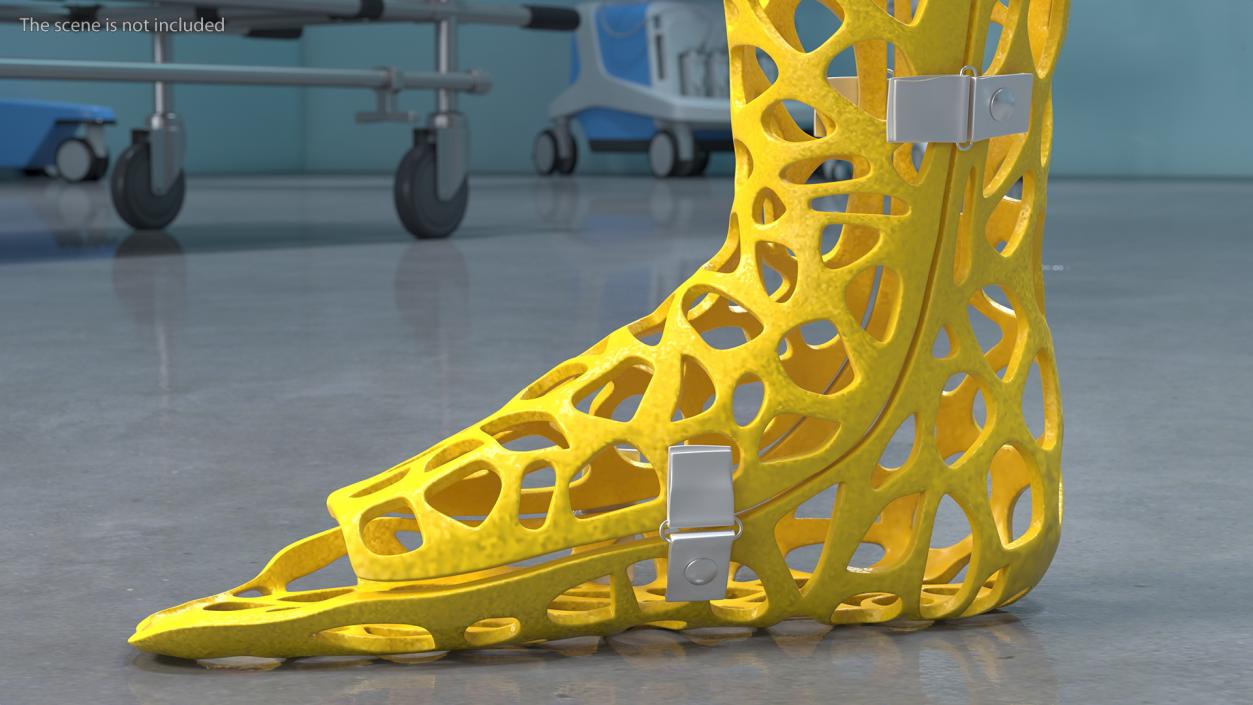 3D model -Printed Orthopedic Cast Leg Yellow