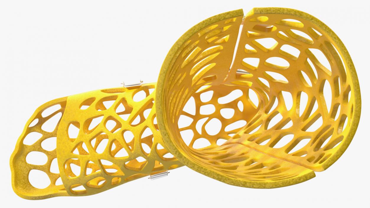 3D model -Printed Orthopedic Cast Leg Yellow