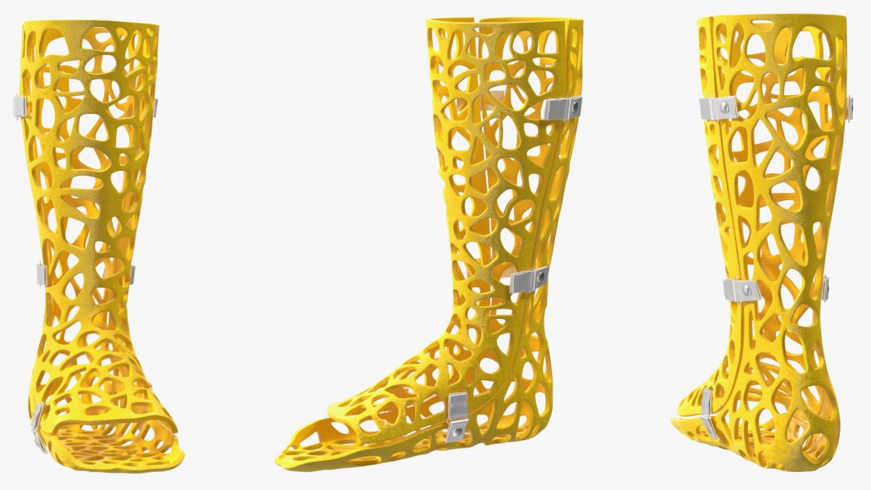 3D model -Printed Orthopedic Cast Leg Yellow