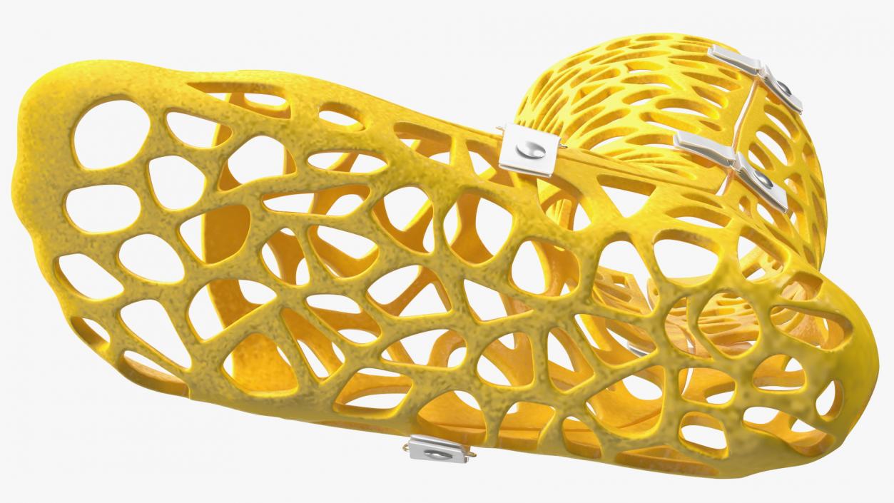 3D model -Printed Orthopedic Cast Leg Yellow