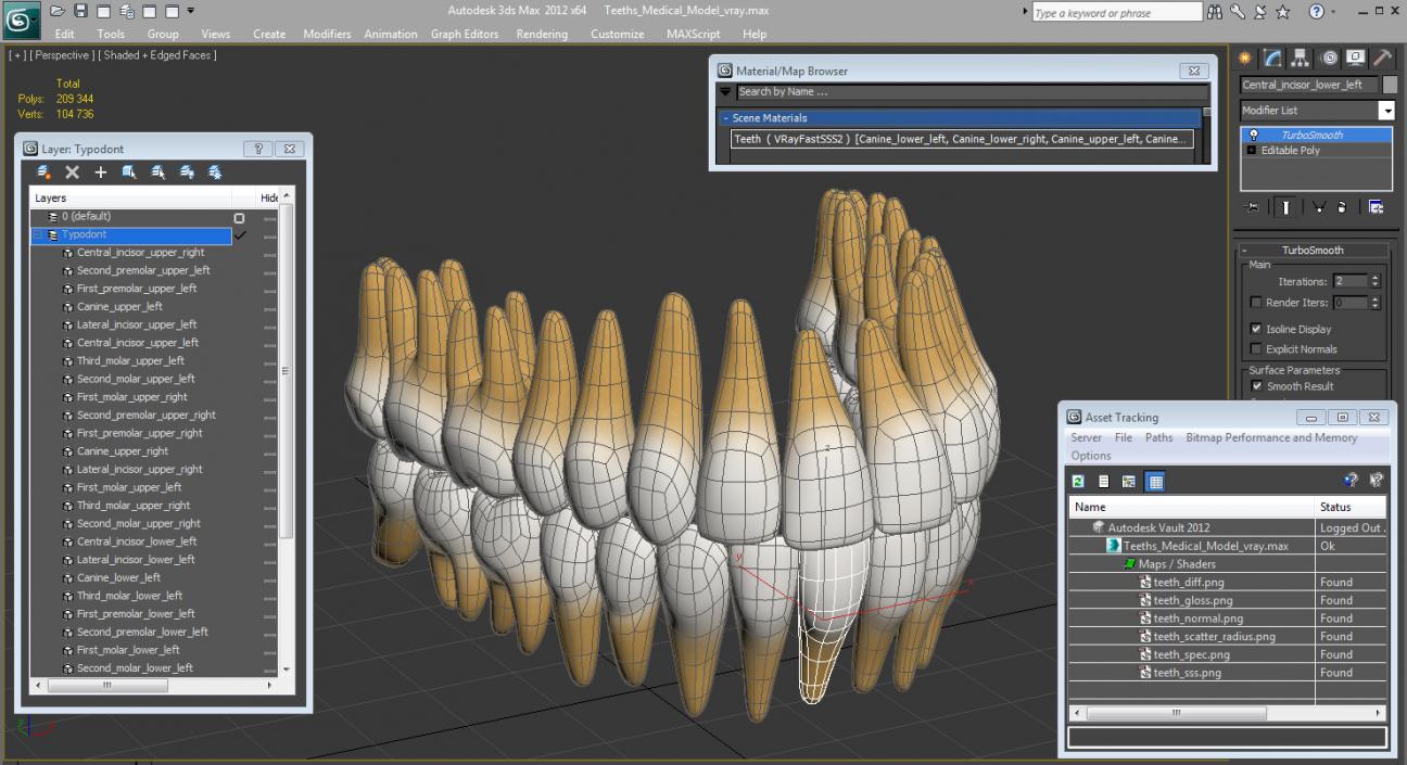 Teeths Medical 3D model