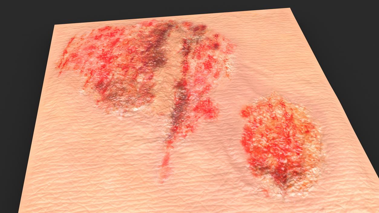 3D Grazed Skin