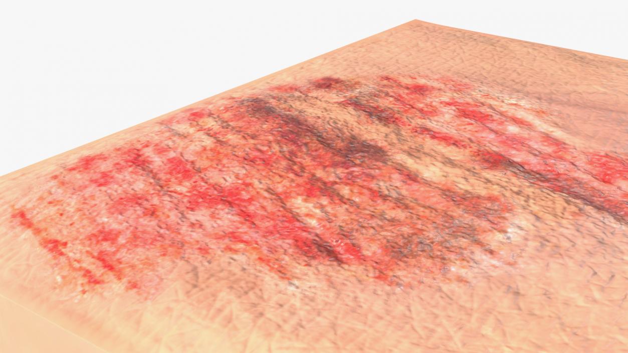 3D Grazed Skin