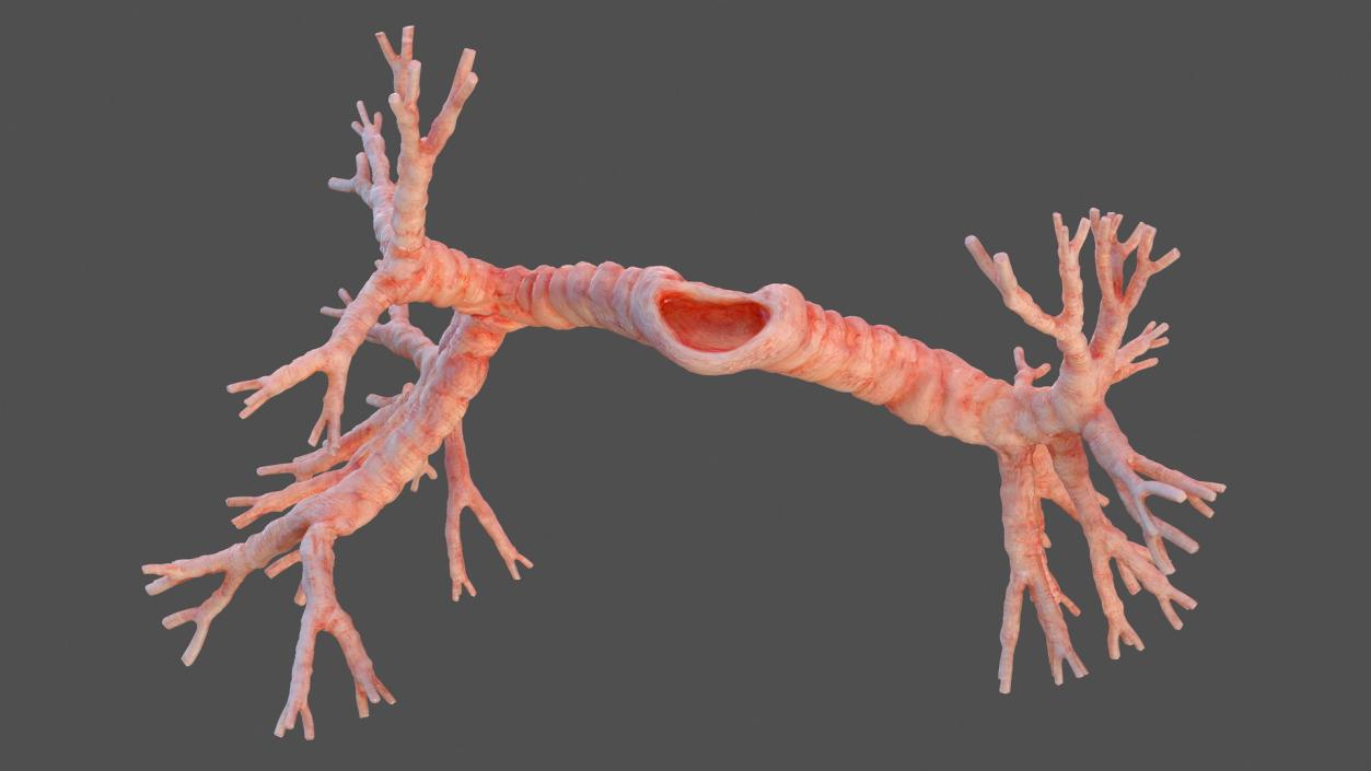 3D Human Bronchi model