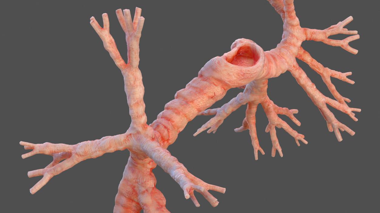 3D Human Bronchi model