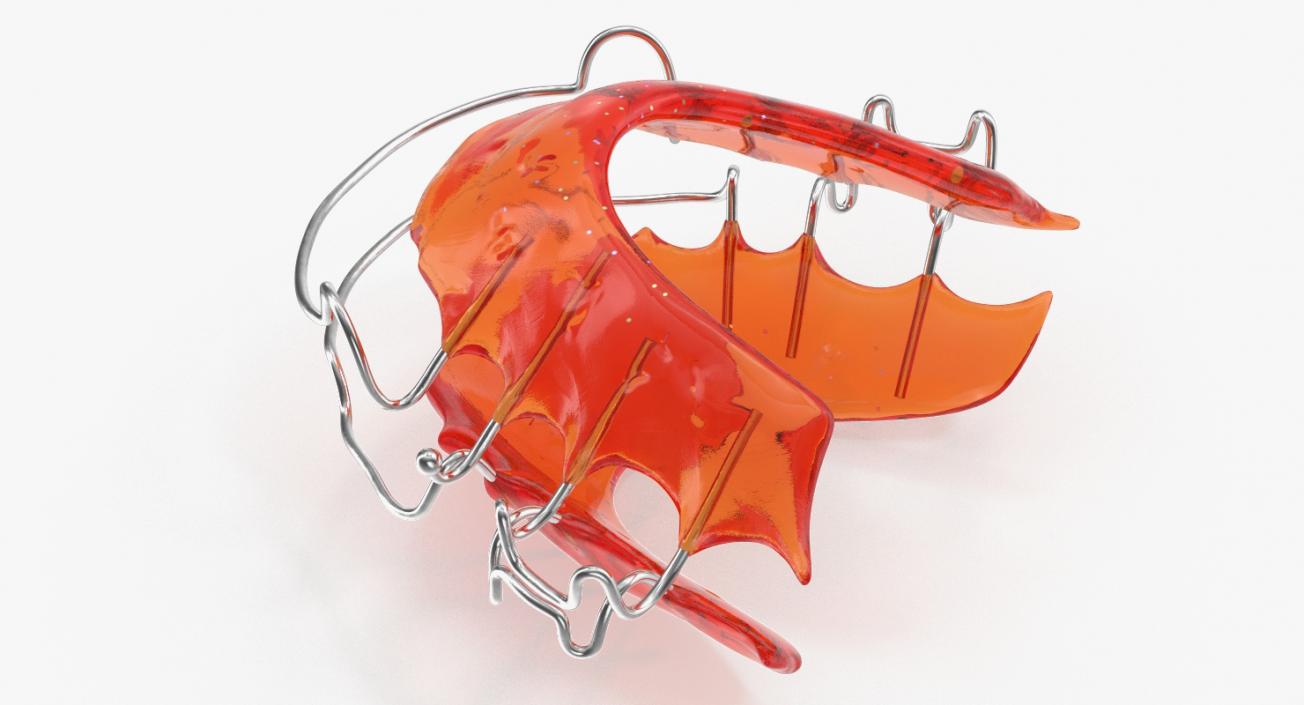 3D Dental Tooth Retainer