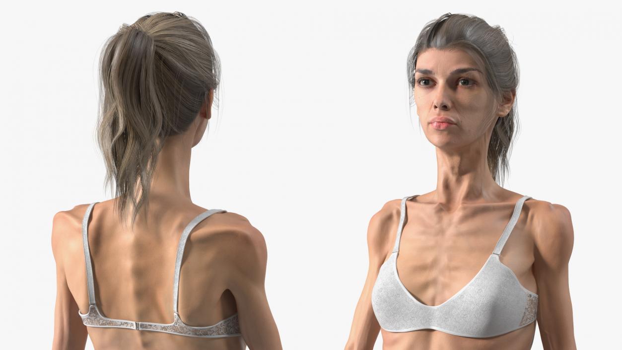 3D Standing Anorexic Woman model