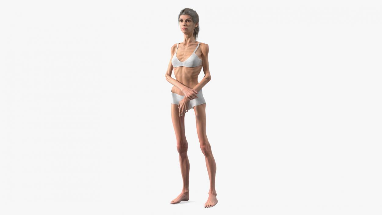 3D Standing Anorexic Woman model