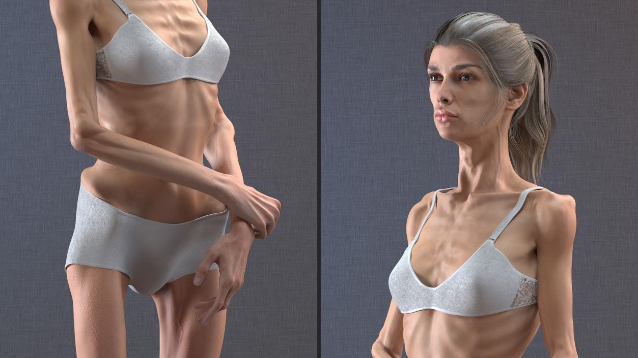 3D Standing Anorexic Woman model