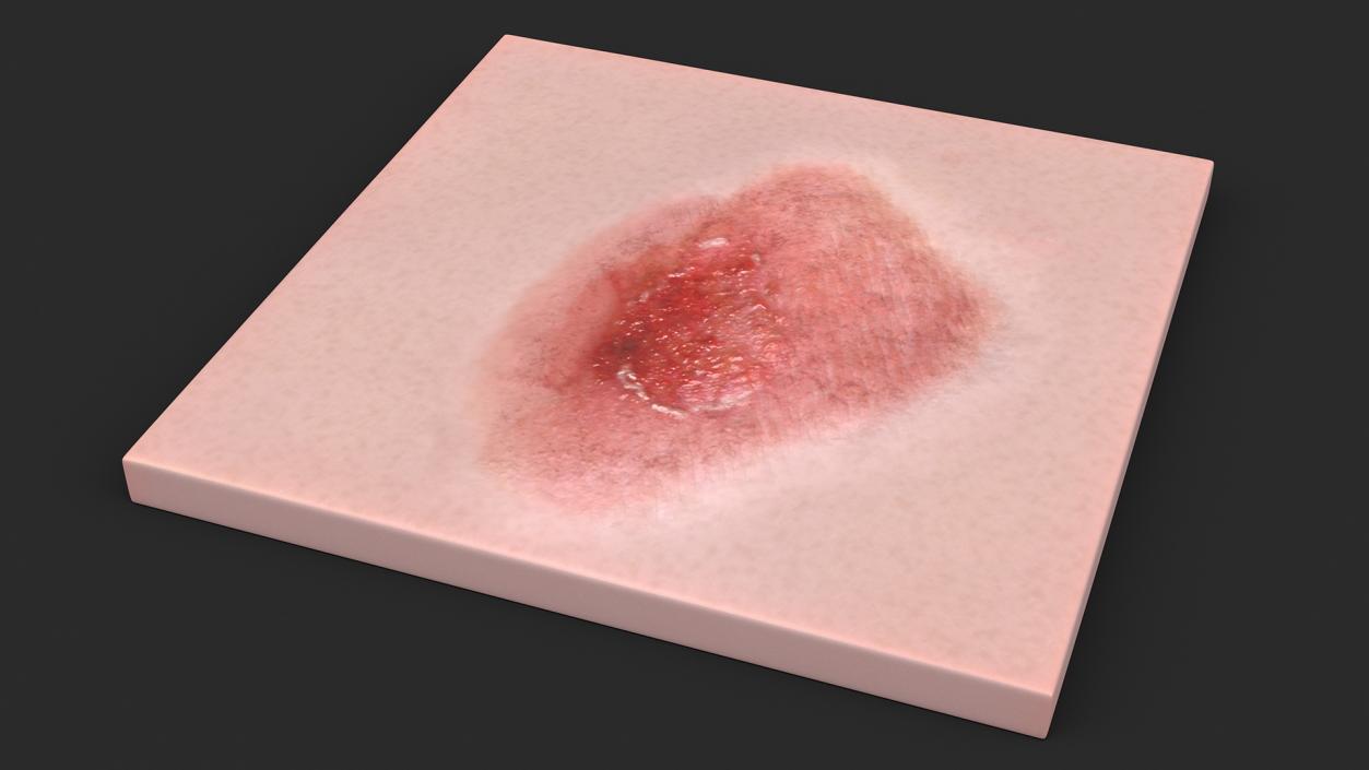 Skin Surfaces Collection 3D model