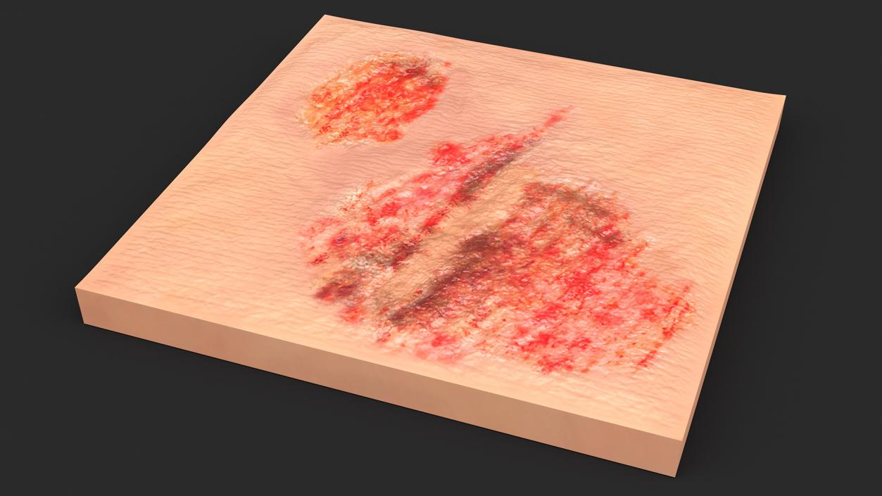 Skin Surfaces Collection 3D model