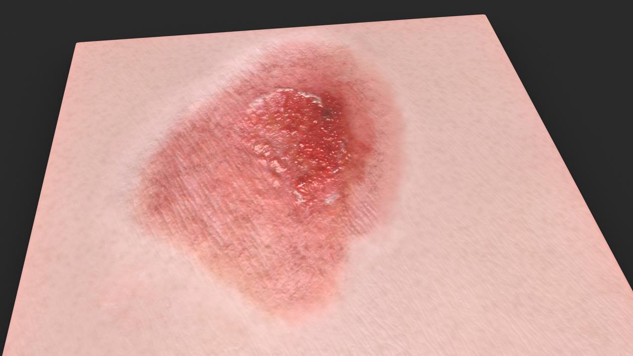 Skin Surfaces Collection 3D model