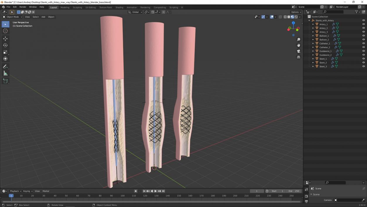 3D model Stents with Artery 2