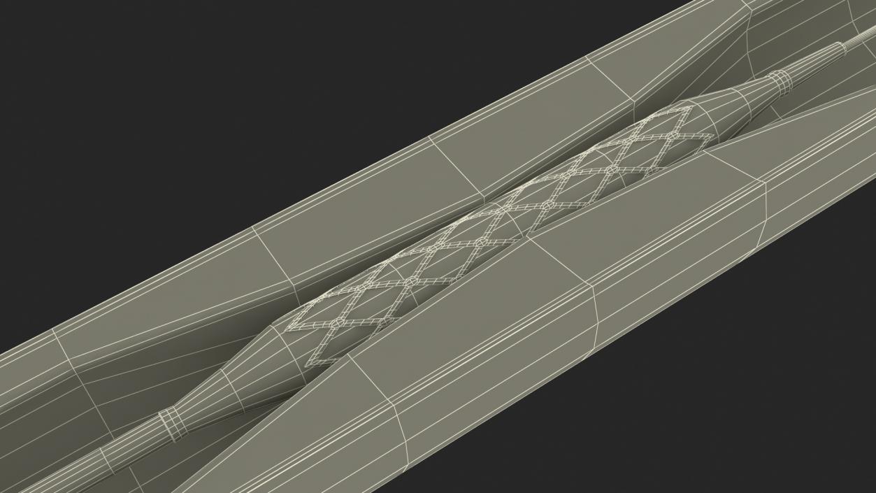 3D model Stents with Artery 2