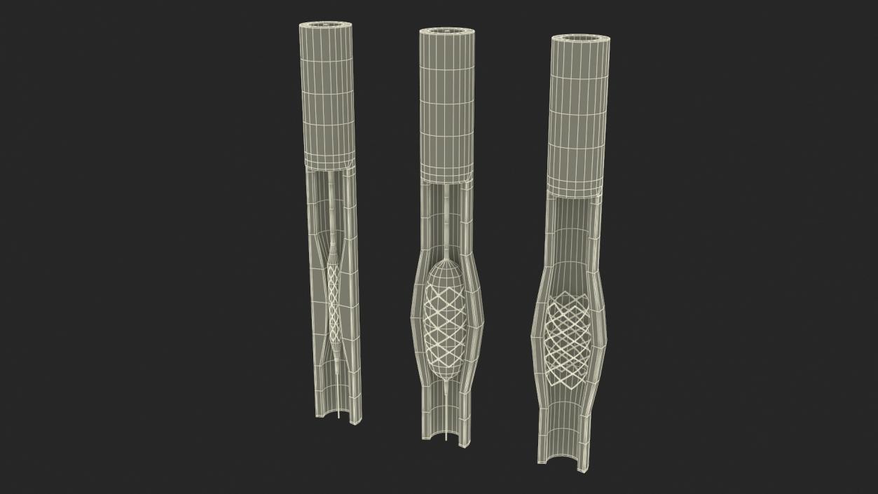 3D model Stents with Artery 2