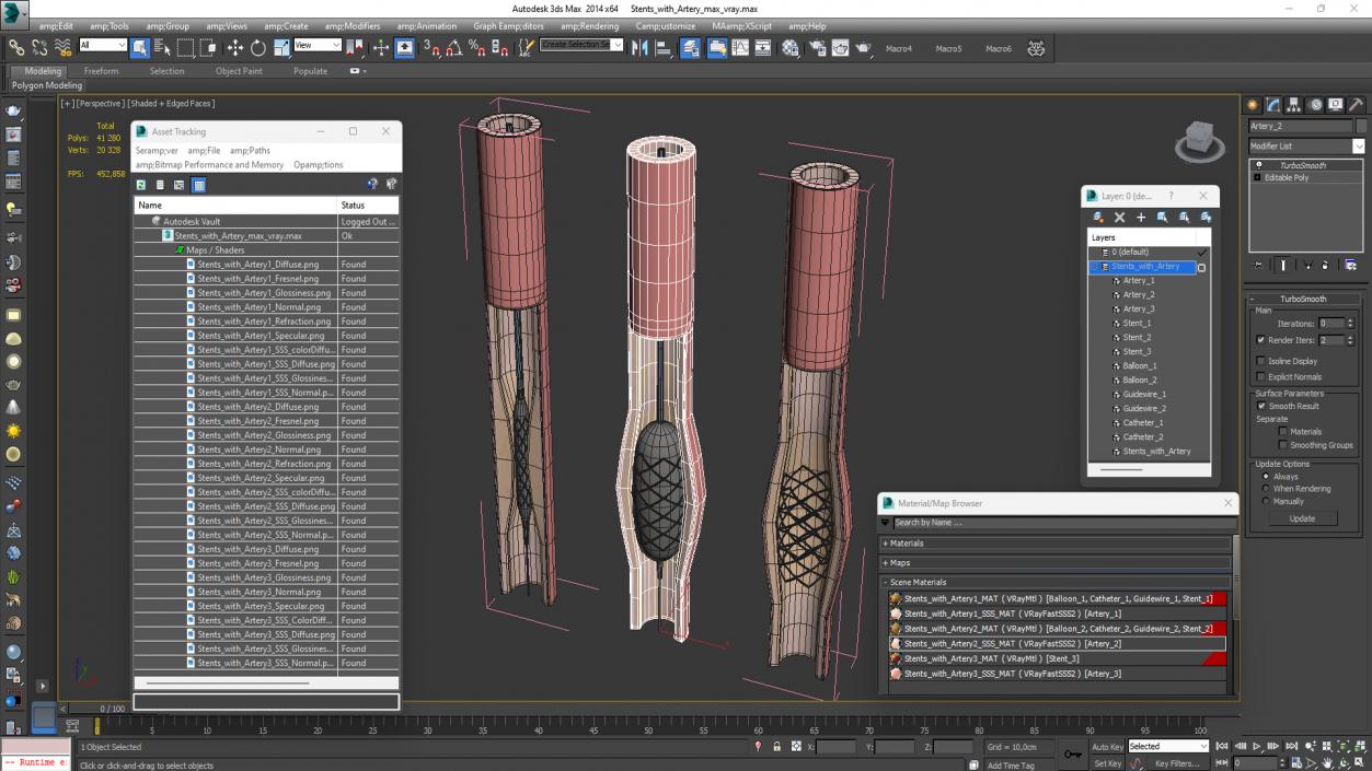 3D model Stents with Artery 2