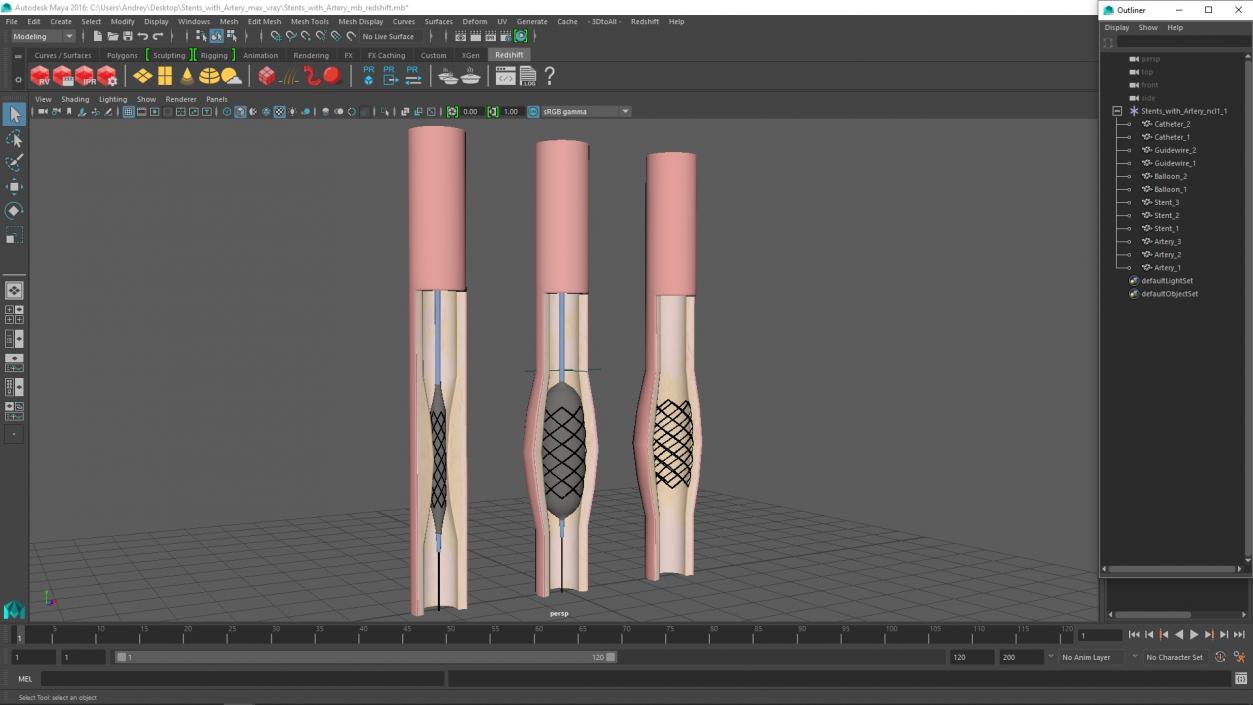 3D model Stents with Artery 2