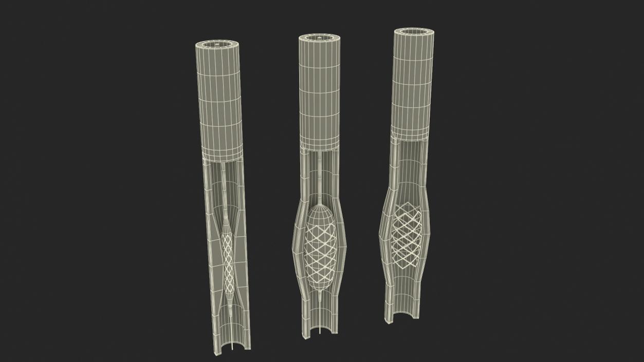 3D model Stents with Artery 2