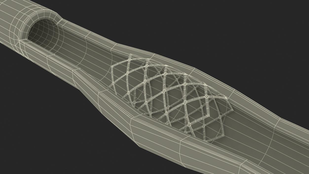 3D model Stents with Artery 2