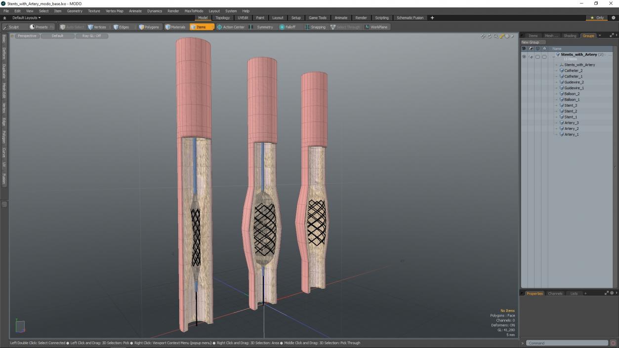 3D model Stents with Artery 2