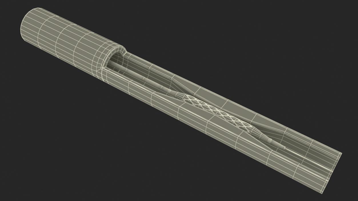 3D model Stents with Artery 2