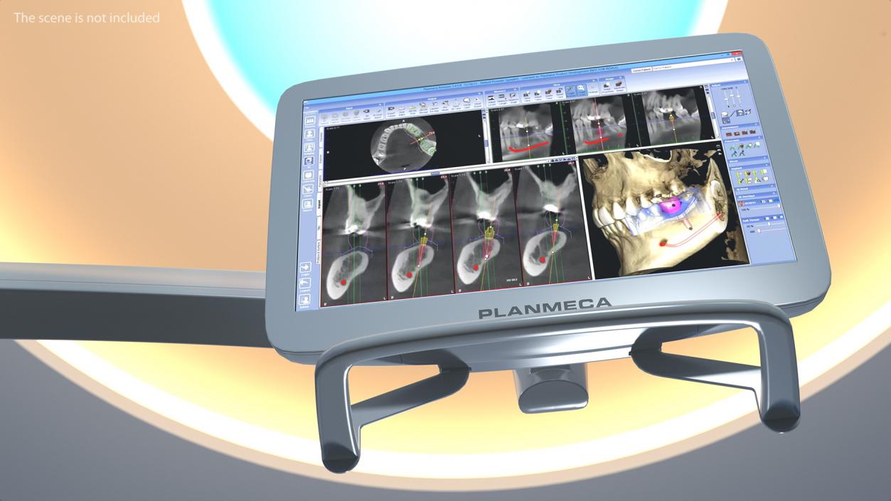 Planmeca Serenus Medical Display 3D