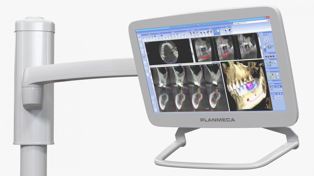 Planmeca Serenus Medical Display 3D